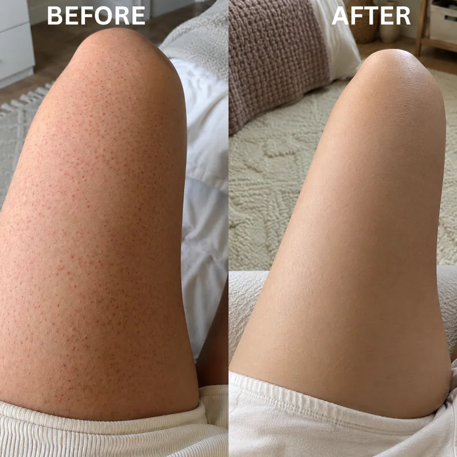 Resurface + Recondition Body Cream