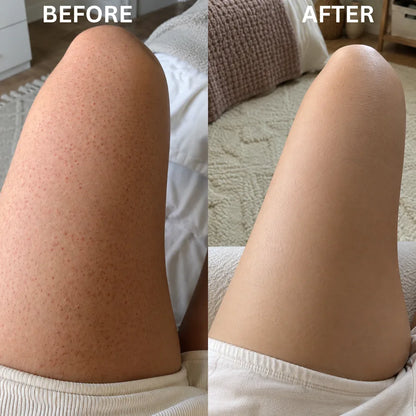 Resurface + Recondition Body Cream